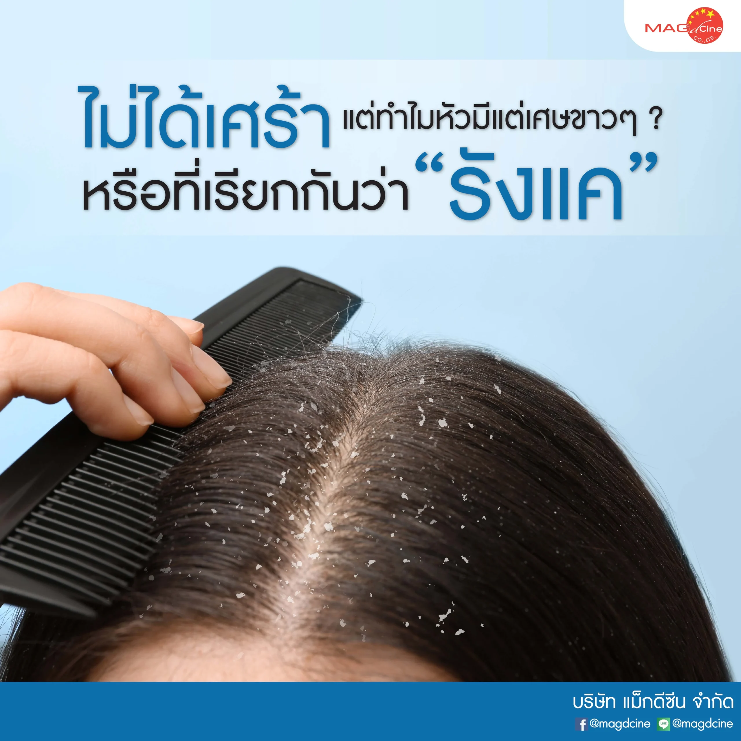 ชุดตรวจสารเสพติด ที่ตรวจสารเสพติด ชนิดจุ่ม ชนิดหยด เครื่องมือทางการแพทย์ 102 อาการ "ไม่ได้เศร้า แต่ทำไมหัวมีแต่เศษขาวๆ" หรือที่เรียกกันว่า "รังแค" แก้ได้ด้วย ทาร์แชมพู