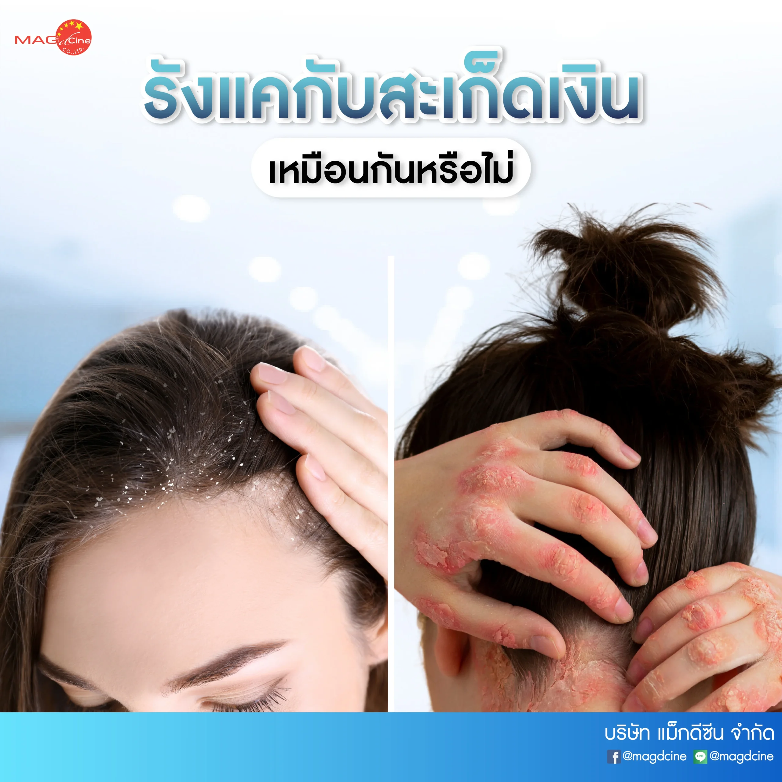 ชุดตรวจสารเสพติด ที่ตรวจสารเสพติด ชนิดจุ่ม ชนิดหยด เครื่องมือทางการแพทย์ 102 21 scaled ชุดตรวจสารเสพติด ที่ตรวจสารเสพติด ชนิดจุ่ม ชนิดหยด เครื่องมือทางการแพทย์