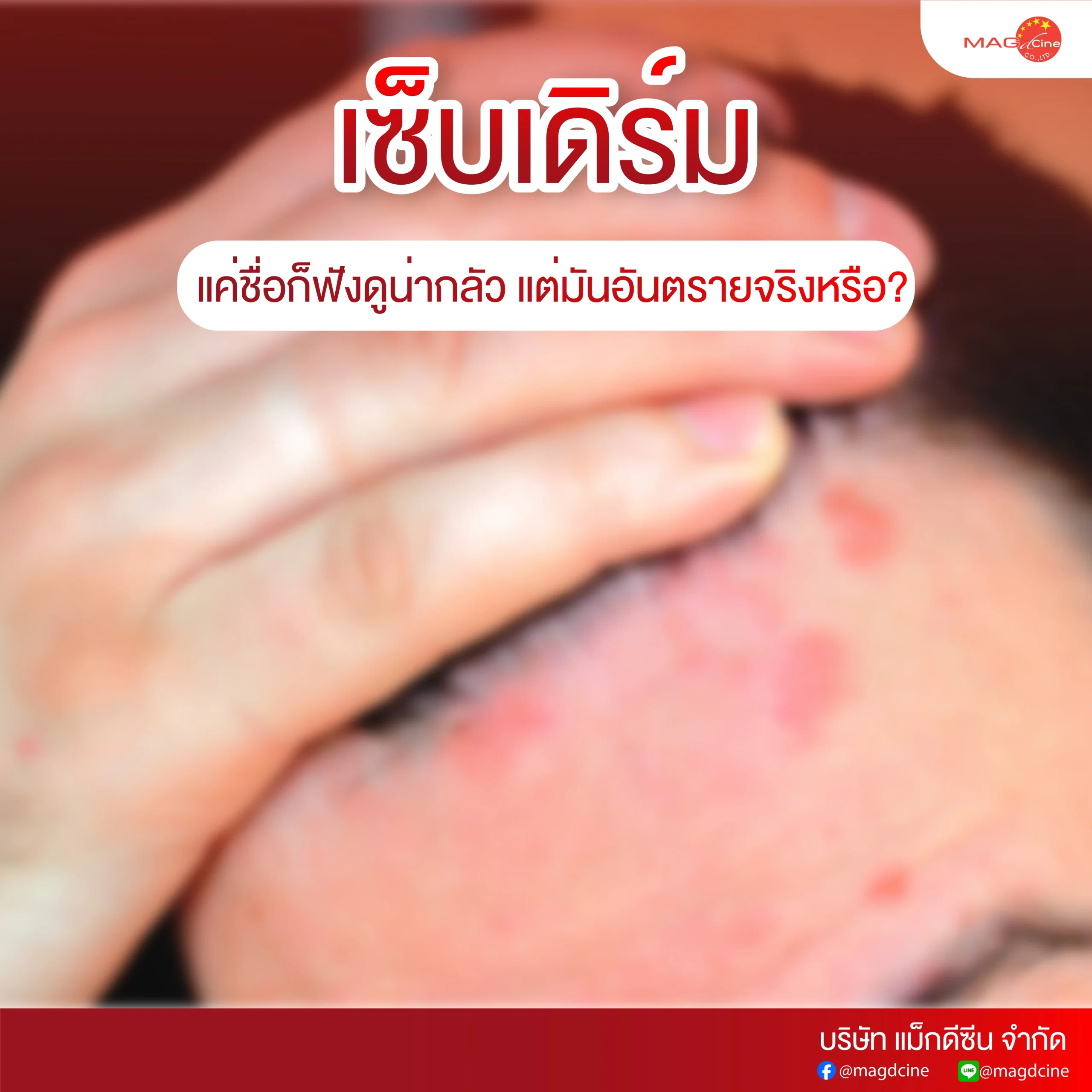 ชุดตรวจสารเสพติด ที่ตรวจสารเสพติด ชนิดจุ่ม ชนิดหยด เครื่องมือทางการแพทย์ 102 scaled ชุดตรวจสารเสพติด ที่ตรวจสารเสพติด ชนิดจุ่ม ชนิดหยด เครื่องมือทางการแพทย์